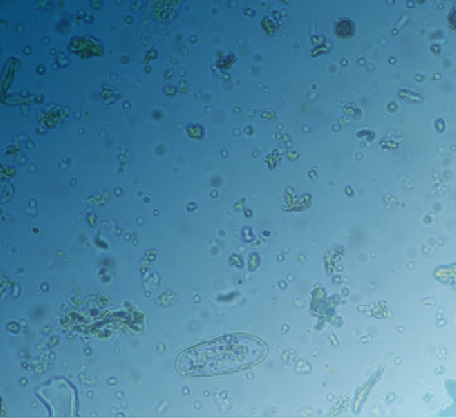 fungicide microscopic view